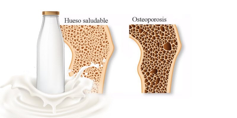 Importancia de consumo de lácteos y la osteoporosis